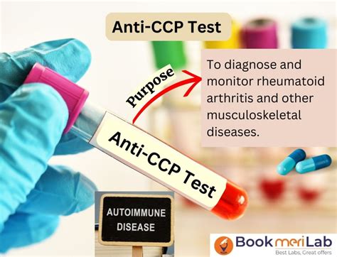 anti ccp test price|anti ccp antibodies blood test.